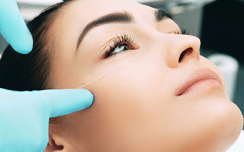 مراقبت بعد از زاویه سازی صورت کدامند؟