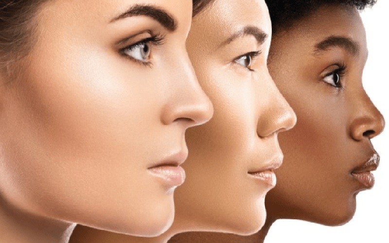 زاویه سازی صورت چیست؟ انواع روش ها و هزینه های آنها