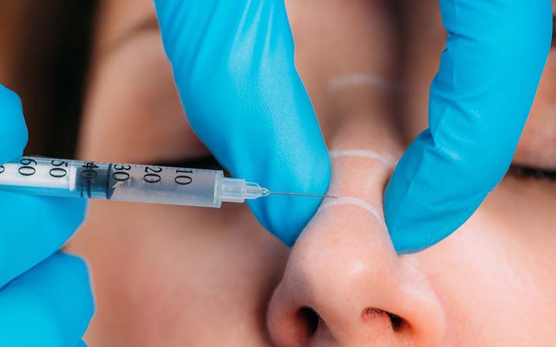 تزریق ژل به بینی + هزینه های تزریق ژل به بینی