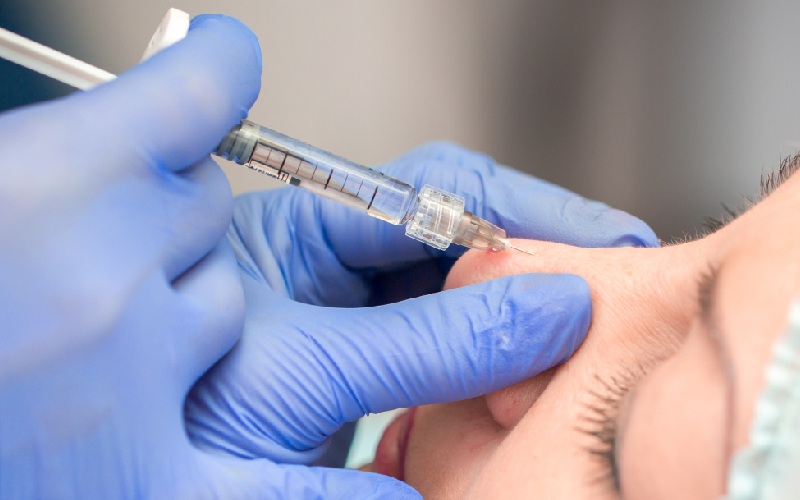 تزریق ژل بینی به انواع فرم بینی متفاوت است؟