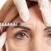 بوتاکس پیشانی: از بین بردن چین و چروک پیشانی
