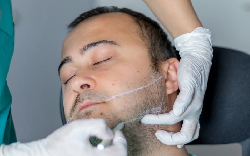 تزریق ژل زاویه فک چگونه انجام می شود؟ + قیمت