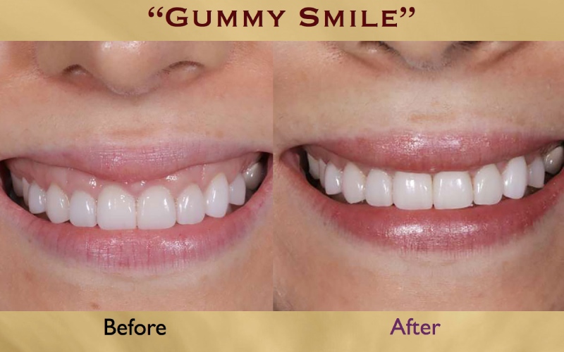 این درمان برای چه کسانی مناسب نیست؟