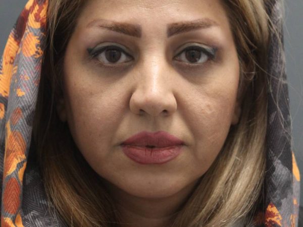 نمونه کار بلفاروپلاستی