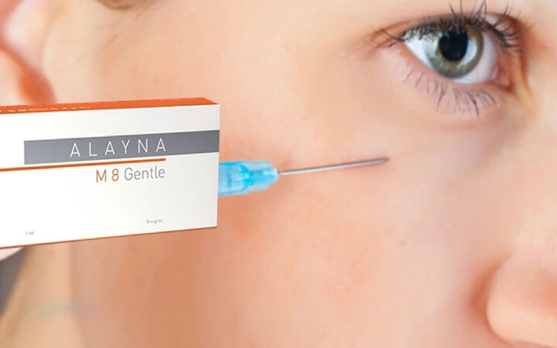 تزریق ژل آلاینا؛ مزایا، کاربرد و قیمت