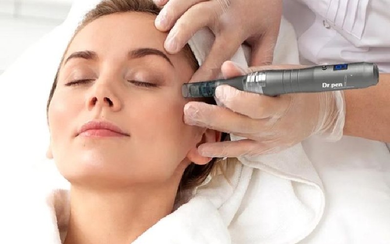 میکرونیدلینگ برای چه افرادی مناسب است؟