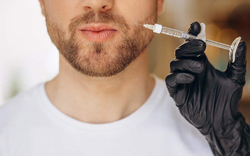 هزینه زاویه سازی فک با تزریق چربی