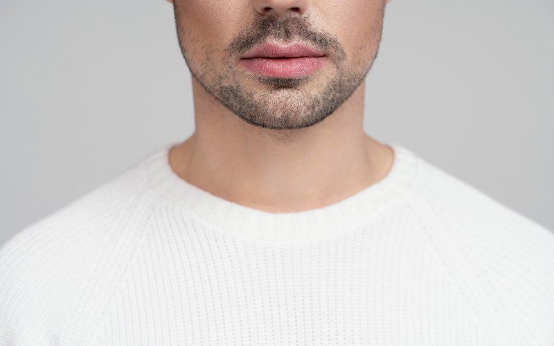 آمادگی قبل از زاویه سازی فک با آر اف